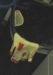 Bloody glove